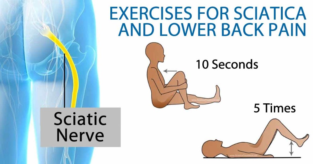 Exercises For Sciatica & Lower Back Pain – Favero Chiropractic