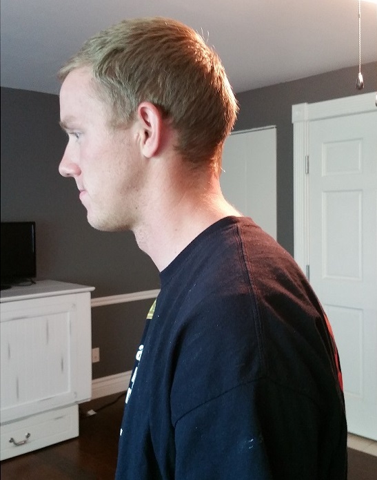 standing posture, forward head