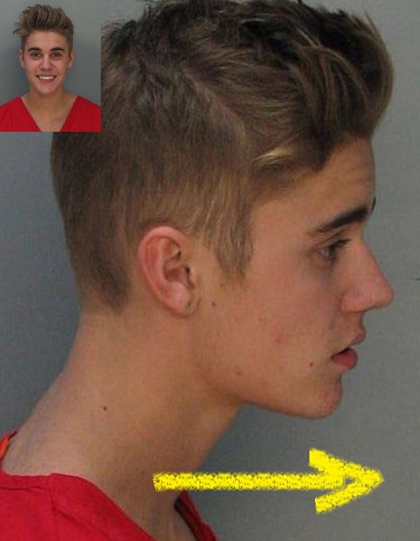 Justin Bieber mugshot, forward head posture